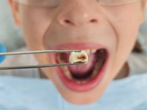 Best Urgent Care for Lost Fillings or Crowns in Victory Lakes, NJ
